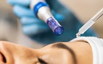 Micro-Needling als sanfte und effektive Anti-Aging-Behandlung