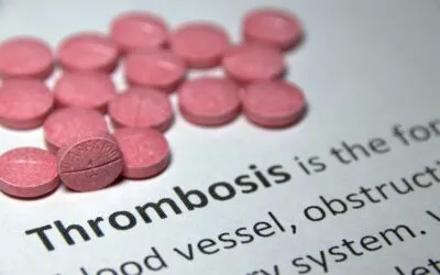 Thrombose Gefahren – Tipps und Tricks für Flugreisen