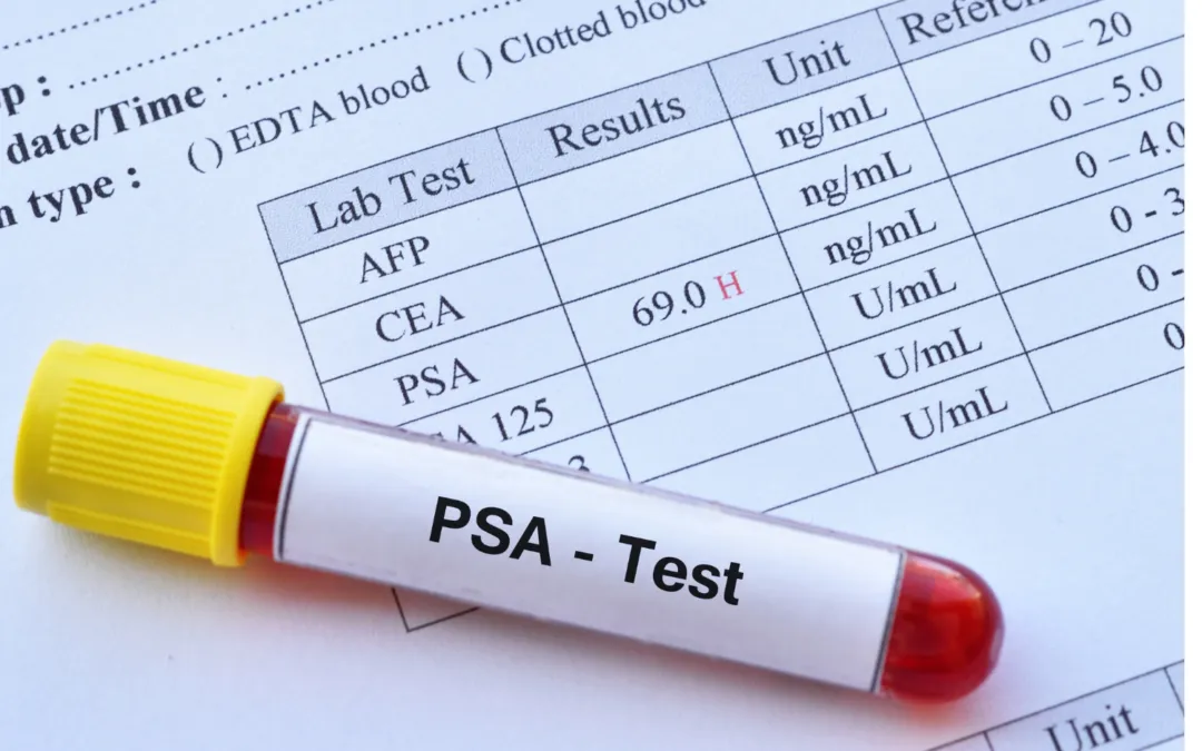 PSA-Test